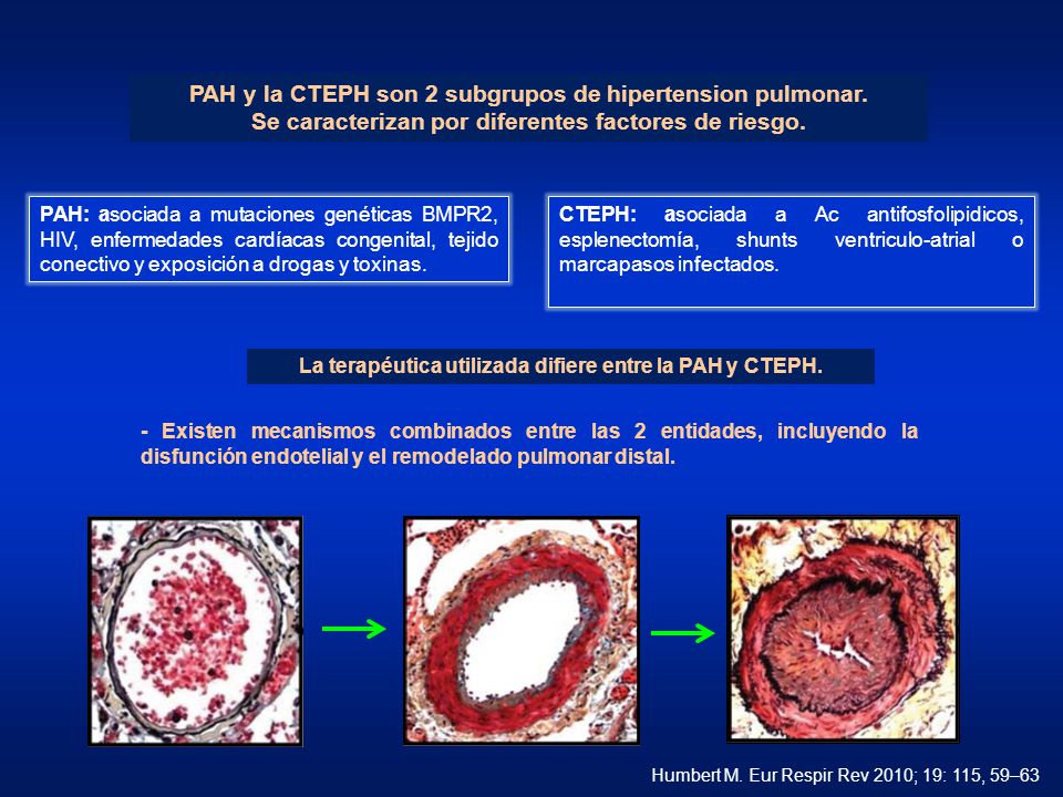 Causas de hipertensión pulmonar-marcapasos